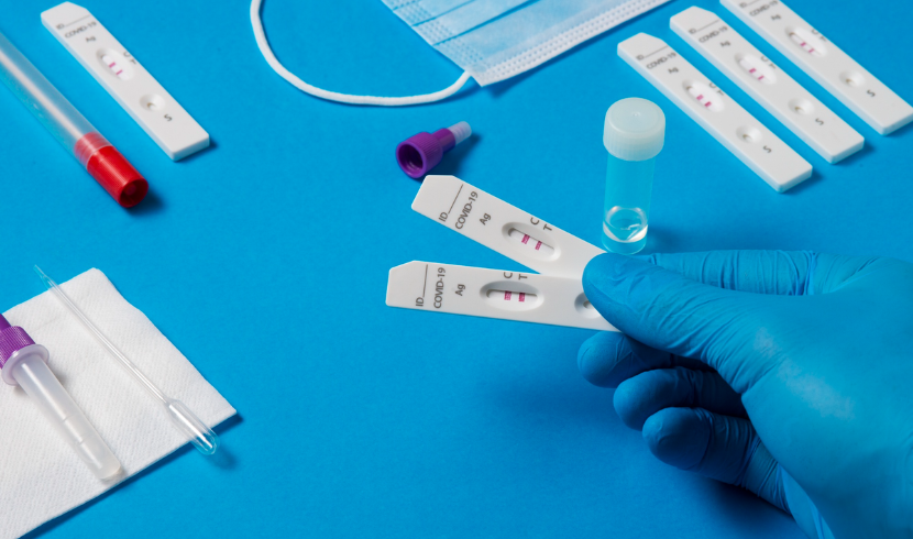 Human Immunodeficiency Virus (HIV) Rapid Test Kits Market