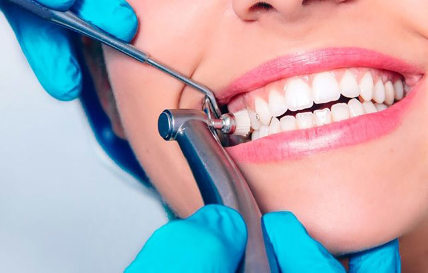 Dental Care Services