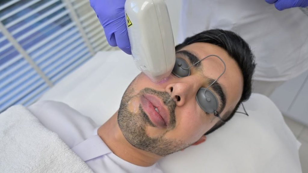 إزالة الشعر بالليزر في دبي